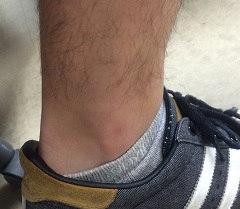 �j�̃��_��